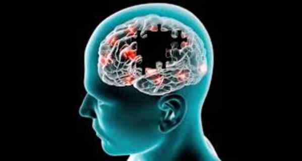 Nuevo ensayo clínico evalúa el tratamiento AAV2-GDNF en adultos con Parkinson moderado
