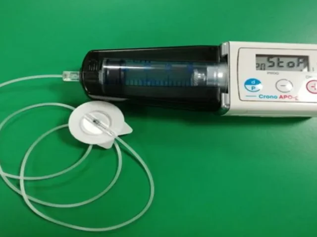 La FDA aprueba un revolucionario tratamiento para el Párkinson avanzado: Onapgo ofrecerá nuevas esperanzas a los pacientes