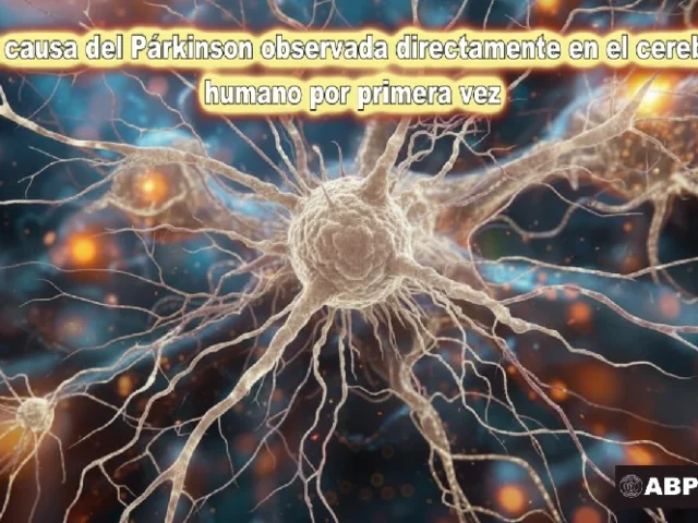 La causa del Párkinson observada directamente en el cerebro humano por primera vez