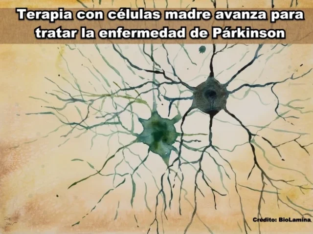 Terapia con células madre avanza para tratar la enfermedad de Párkinson