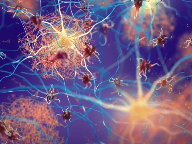 Científicos japoneses descubren cómo detener la formación de proteínas dañinas en enfermedades neurodegenerativas