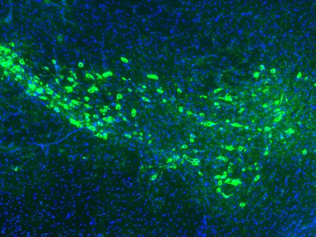 Científicos de Yale descubren cómo se propaga el Párkinson en el cerebro
