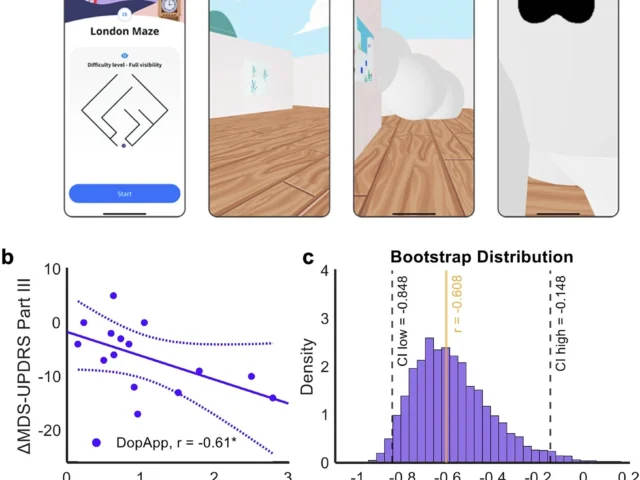 Entrenamiento digital de tres semanas mejora la movilidad y reconecta el cerebro en personas con Párkinson