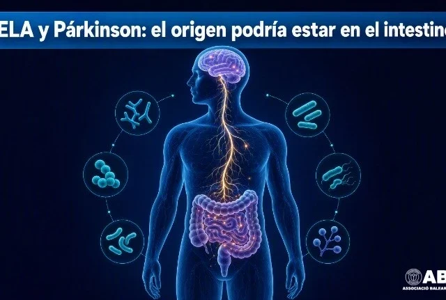 Un estudio sugiere que la ELA y el Párkinson tienen su origen en el intestino