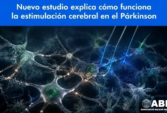 Nuevo estudio explica cómo funciona la estimulación cerebral en el Párkinson
