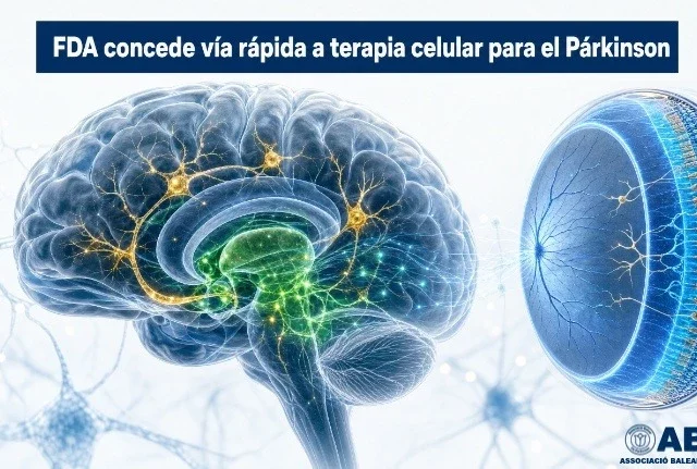 La FDA concede la designación de «vía rápida» a una terapia celular para el Párkinson