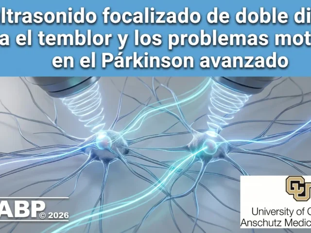 El ultrasonido focalizado de doble diana alivia el temblor y los problemas motores en el Párkinson avanzado